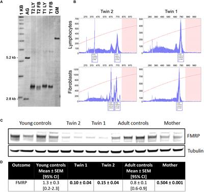 Impact of FMR1 Premutation on Neurobehavior and Bioenergetics in Young Monozygotic Twins